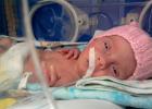Распространенные проблемы недоношенных новорожденных Недоношенные дети последствия в будущем